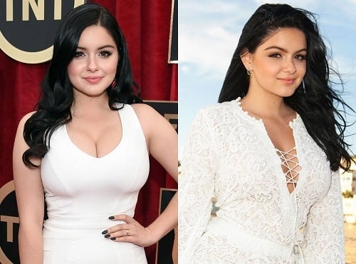 A picture of Ariel Winter before (left) and after (right) breast reduction.